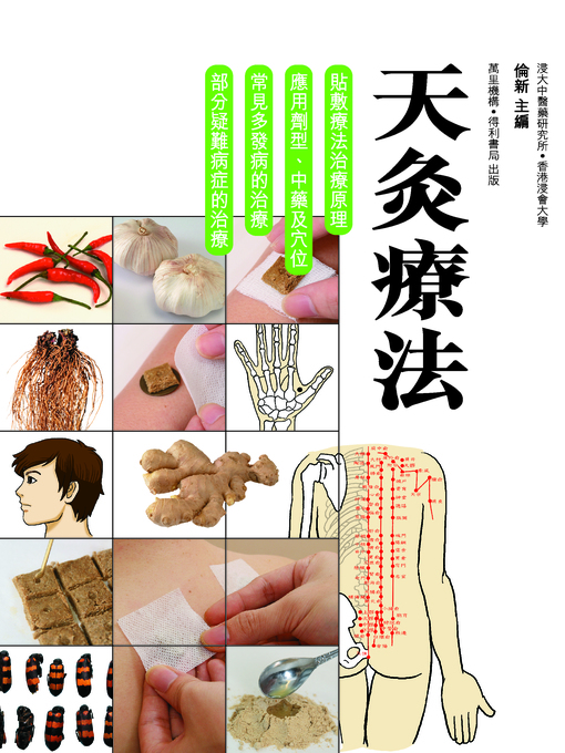 Title details for 天灸療法 by 倫新 - Available